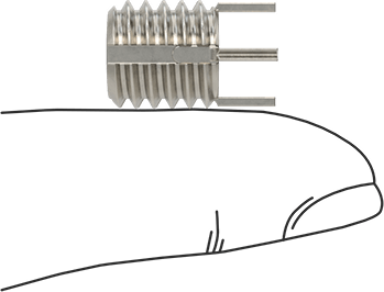 McMaster 93340A415 18-8 Stainless Steel Key-Locking Insert with Thin Wall, 5/16"-18 Thread Size